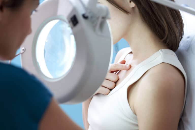 Can A Dermatologist Remove A Cyst?